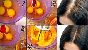 5 maneras fáciles de usar huevos para tratar la pérdida de cabello