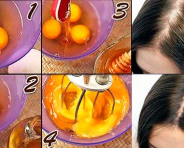 5 maneras fáciles de usar huevos para tratar la pérdida de cabello