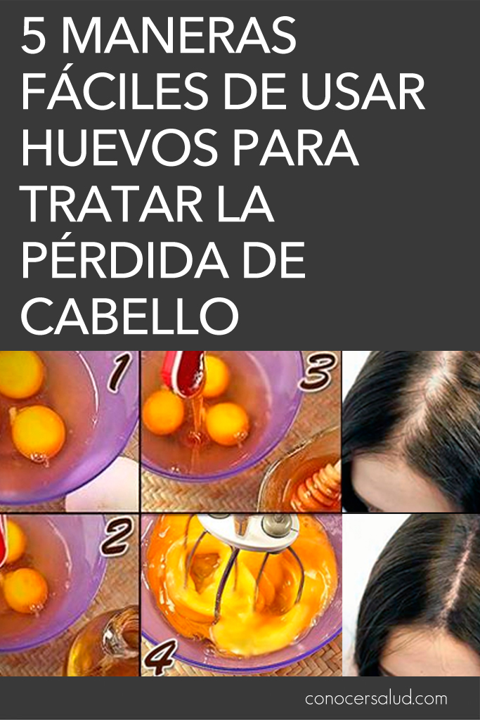 5 maneras fáciles de usar huevos para tratar la pérdida de cabello