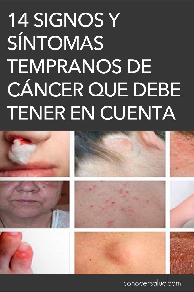 14 signos y síntomas tempranos de cáncer que debe tener en cuenta