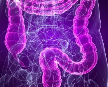 Síndrome del intestino irritable (SII): Un diagnóstico erróneo de endometriosis común