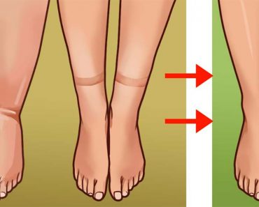 Retención de líquidos (edema): principales causas y cómo solucionarlo naturalmente