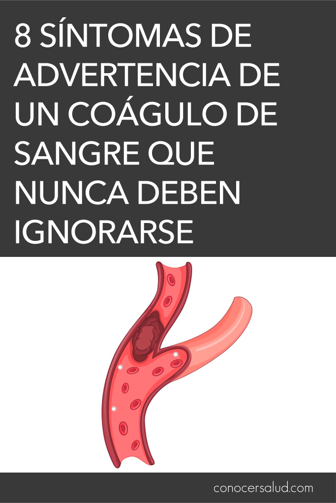 8 síntomas de advertencia de un coágulo de sangre que nunca deben ignorarse