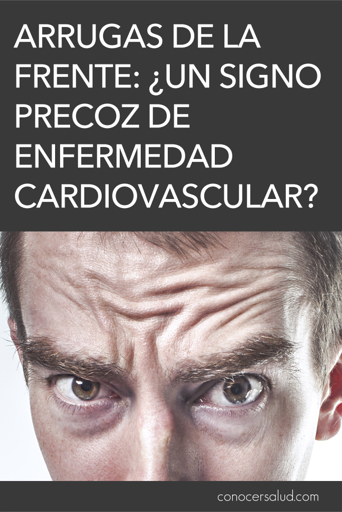 Arrugas de la frente: ¿un signo precoz de enfermedad cardiovascular?