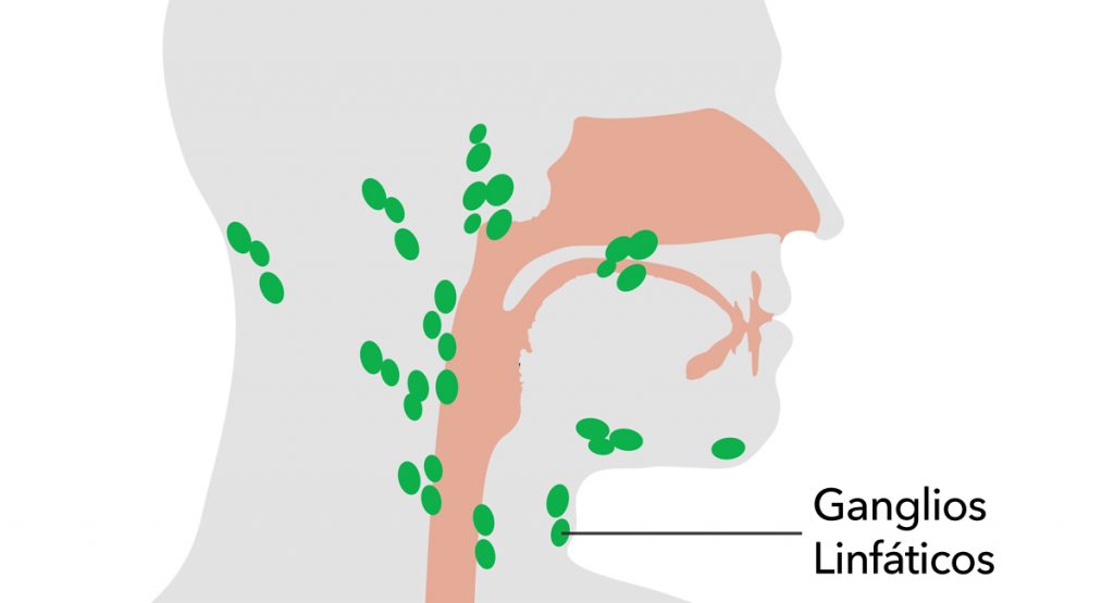 10 remedios caseros para tratar los ganglios linfáticos inflamados