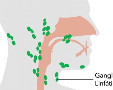 10 remedios caseros para tratar los ganglios linfáticos inflamados