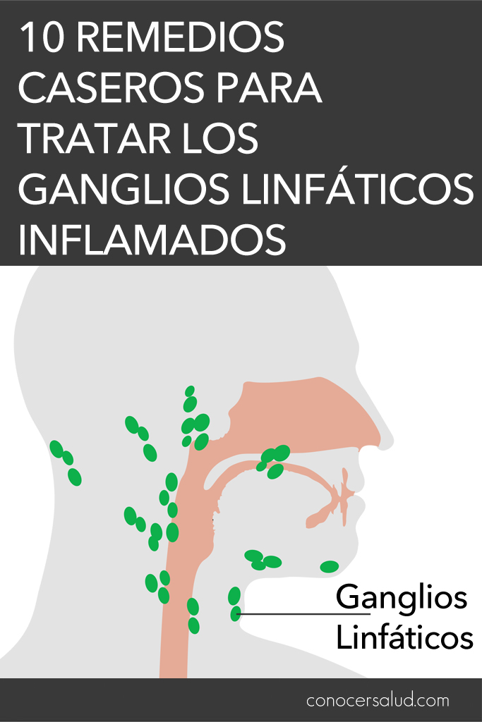 10 remedios caseros para tratar los ganglios linfáticos inflamados