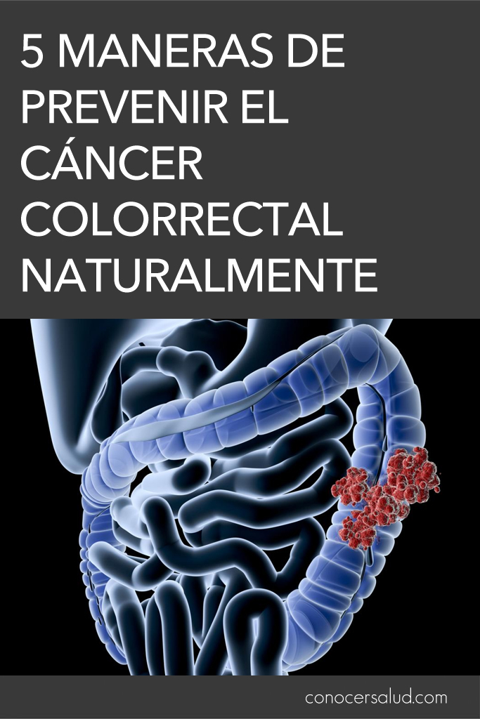 5 maneras eficaces de prevenir el cáncer colorrectal naturalmente