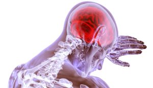 10 señales de advertencia y síntomas de tumores cerebrales que debe saber