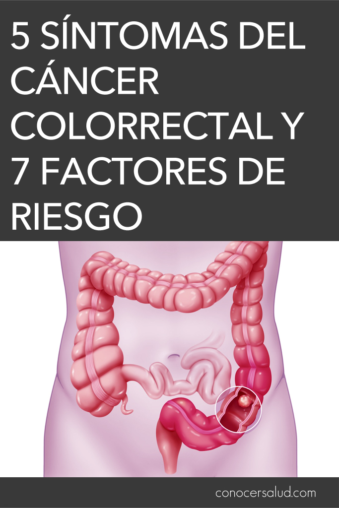 5 Síntomas del cáncer colorrectal y 7 Factores de riesgo