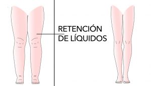 10 Alimentos que ayudan a evitar la retención de líquidos