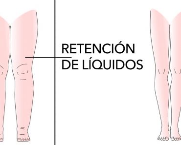 10 Alimentos que ayudan a evitar la retención de líquidos