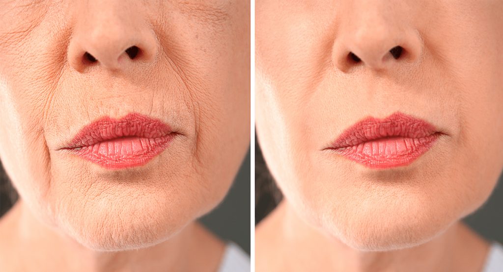 5 Ejercicios faciales que le harán envejecer más lentamente