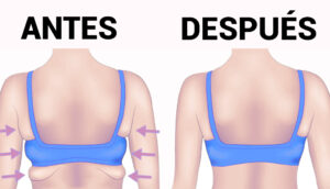 7 ejercicios para eliminar la grasa de la espalda y las axilas en 20 minutos