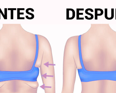 7 ejercicios para eliminar la grasa de la espalda y las axilas en 20 minutos