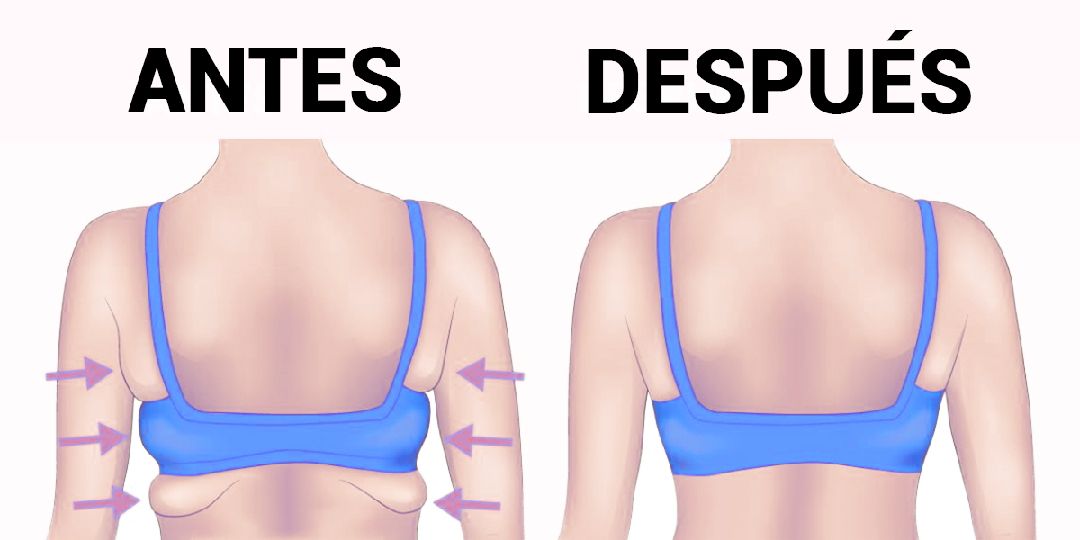 8 ejercicios para eliminar la grasa de la espalda y las axilas en 20 minutos
