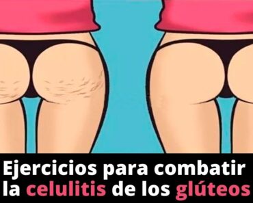 Los 3 mejores ejercicios para combatir la celulitis de los glúteos