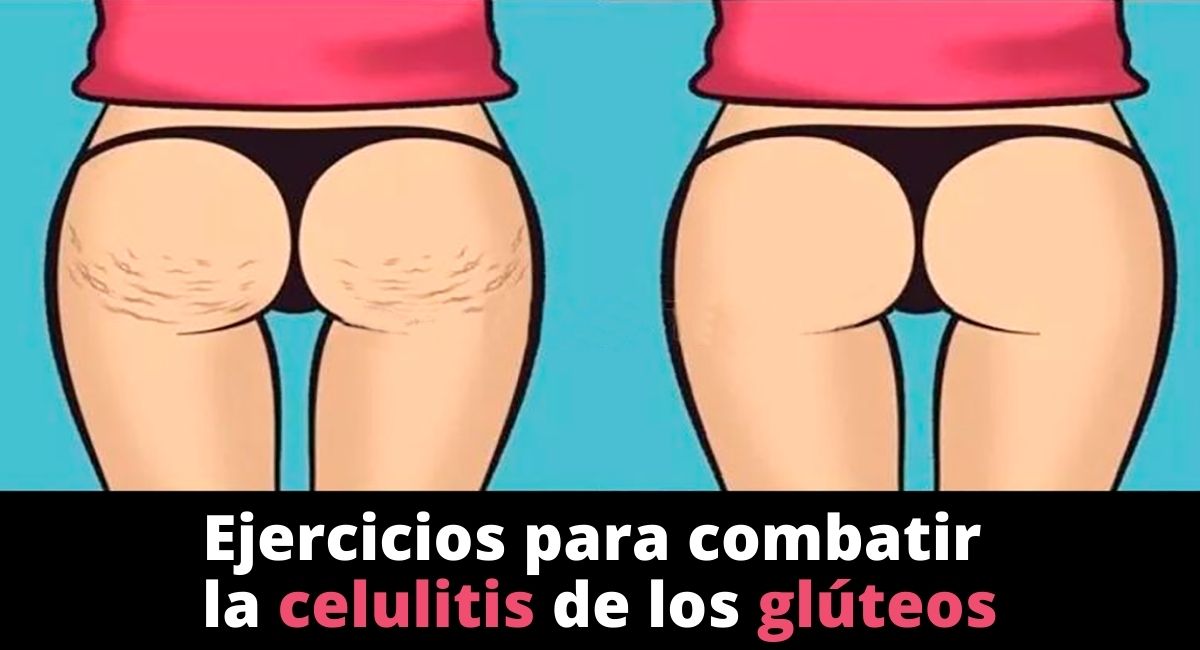 Los 3 mejores ejercicios para combatir la celulitis de los glúteos