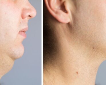 3 Ejercicios eficaces para perder la grasa del cuello y la cara