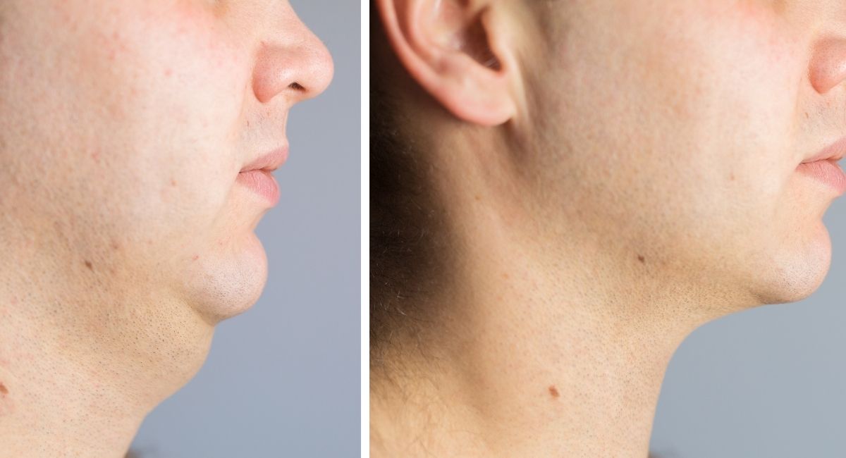 3 Ejercicios eficaces para perder la grasa del cuello y la cara