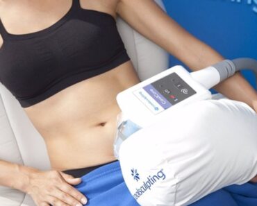 Los beneficios del "CoolSculpting" para quemar grasa, según un experto