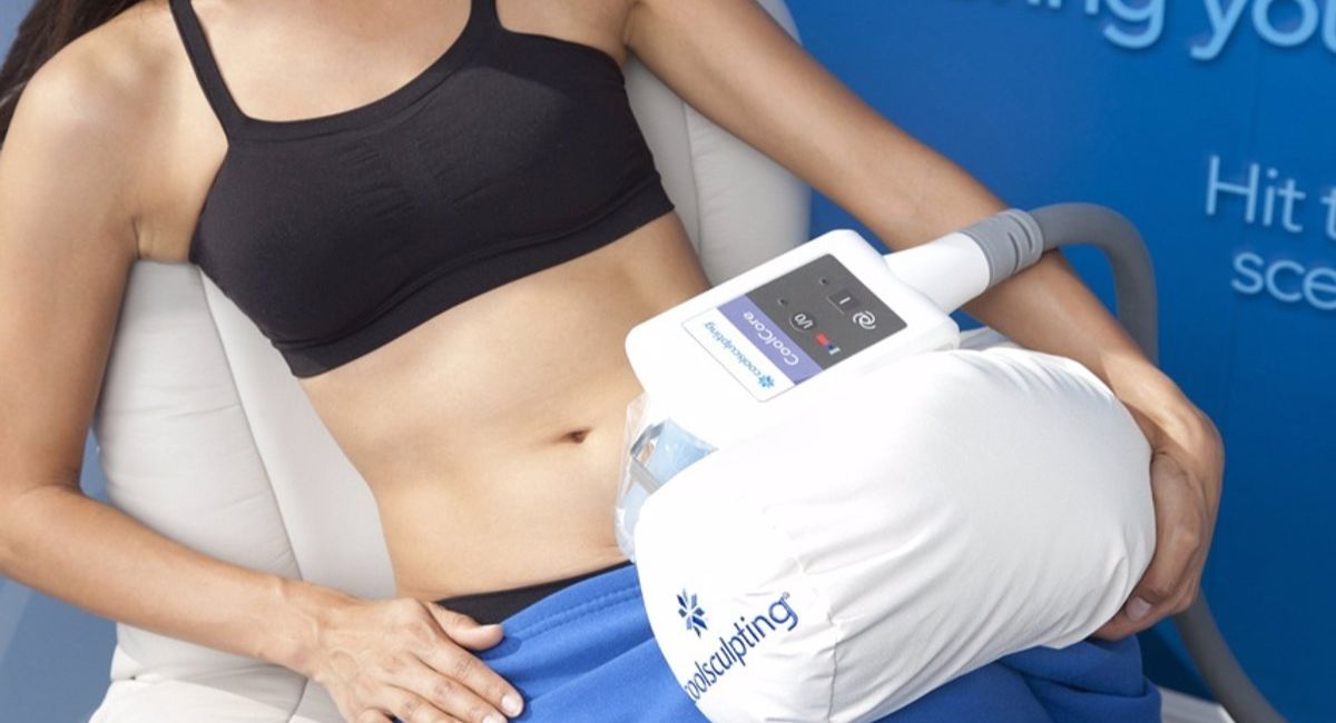 Los beneficios del "CoolSculpting" para quemar grasa, según un experto