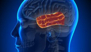 ¿Qué causa un coágulo de sangre en el cerebro? Un médico opina