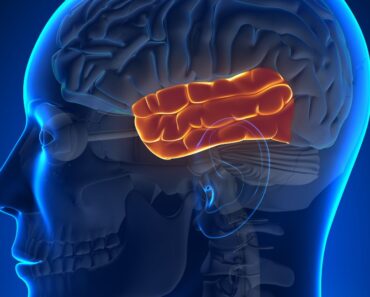 ¿Qué causa un coágulo de sangre en el cerebro? Un médico opina