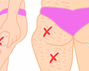 Los 3 ejercicios más eficaces para eliminar la celulitis, según un entrenador