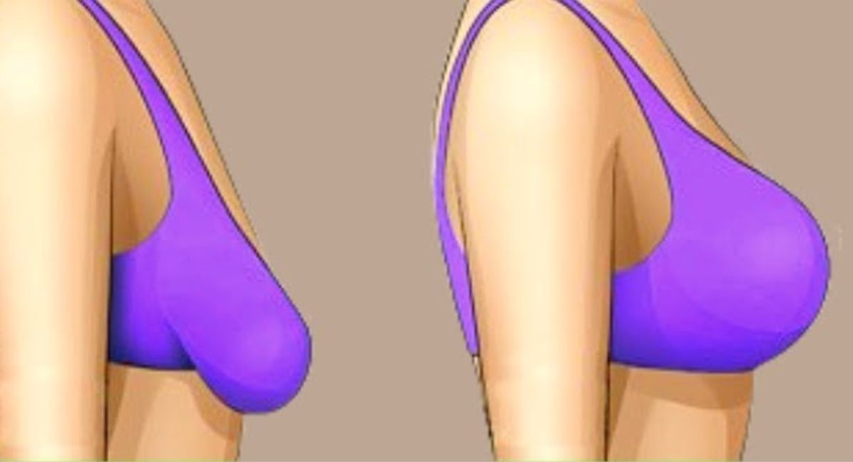 ¿Cómo levantar los senos caídos? Los mejores ejercicios de levantamiento de senos y métodos naturales