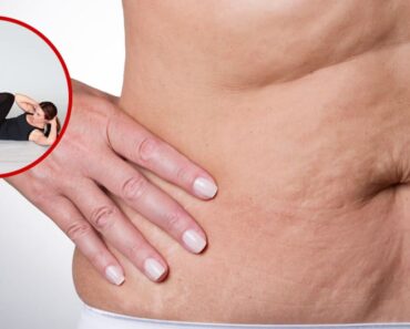 Elimina la flacidez abdominal en tiempo récord: 4 ejercicios infalibles que tonifican Elimina la flacidez abdominal en tiempo récord: 4 ejercicios infalibles que tonifican