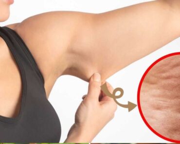 Cómo eliminar la celulitis de los brazos con una sencilla rutina de ejercicios Cómo eliminar la celulitis de los brazos con una sencilla rutina de ejercicios