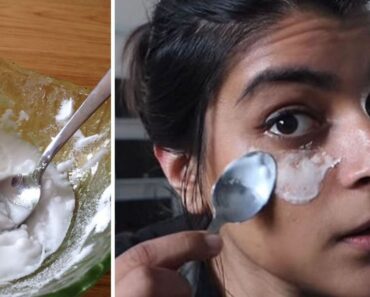Cómo eliminar las manchas de la piel, las arrugas y las ojeras con bicarbonato de sodio Cómo eliminar las manchas de la piel, las arrugas y las ojeras con bicarbonato de sodio