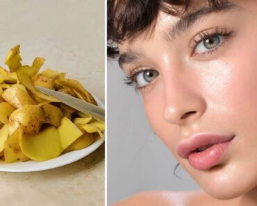 Mascarilla de cáscara de patata para eliminar manchas y alisar la piel Mascarilla de cáscara de patata para eliminar manchas y alisar la piel