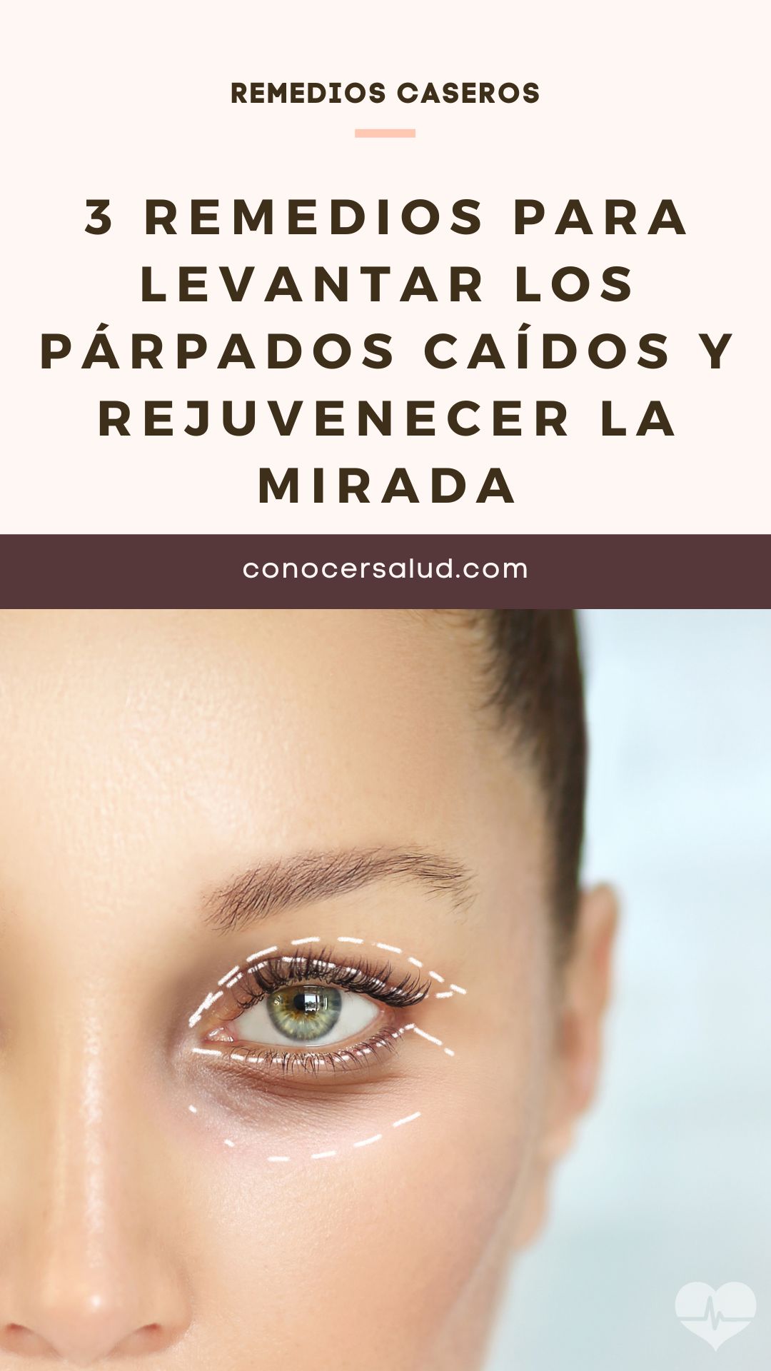 3 remedios para levantar los párpados caídos y rejuvenecer la mirada