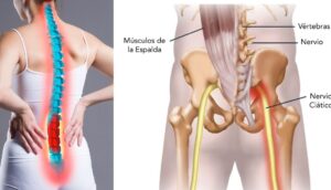 Te explicamos por qué tienes ciática y cómo aliviar el dolor de ciática