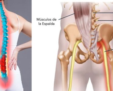 Te explicamos por qué tienes ciática y cómo aliviar el dolor de ciática