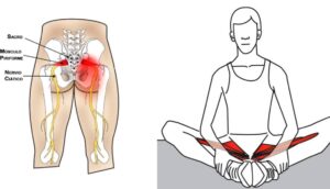 6 ejercicios para aliviar el dolor de ciática y espalda lubricando las articulaciones