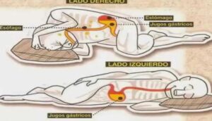 Por qué dormir sobre el lado izquierdo puede cambiar tu vida